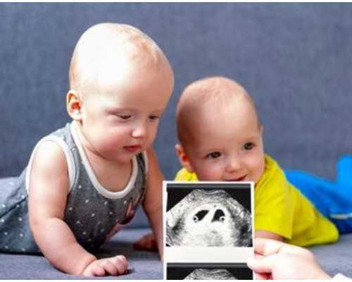 深圳助孕价格,深圳代生男孩,深圳代生妈妈,沈阳单身女人找代孕_法斗犬注意事